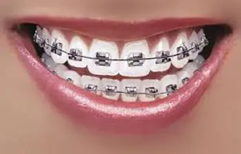 dental ortho marketing