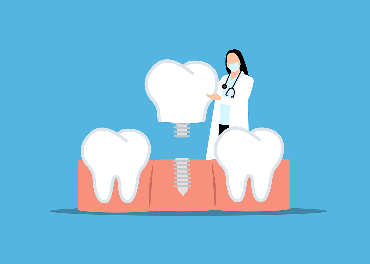 dental implant markets